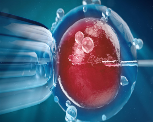 探究辅助生殖技术费用:医院级别与医生经验的影响