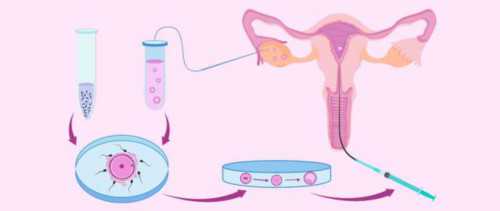 哪代试管技术能助您实现生育梦想