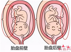 杭州代孕：孕期运动方法  三大方法孕妇须知道