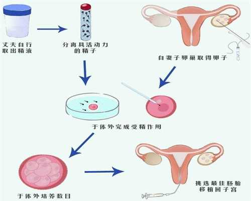 贵阳代孕工具：孕12+1检查有宫腔积液，宝宝鼻骨