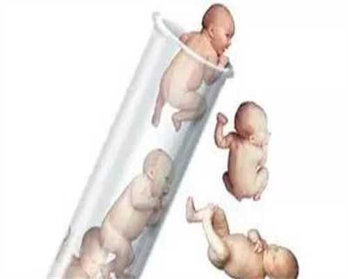徐州代孕费用：孕妇有这4个特征，胎儿通常不会