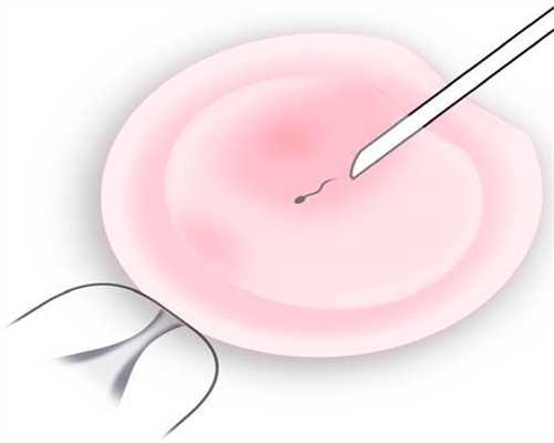惠州代孕网：孕期常做这3件事，很可能会加重脐