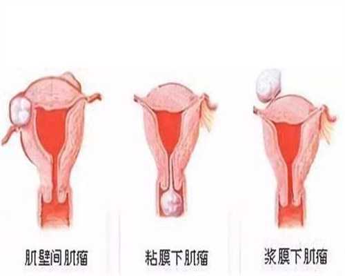 宿迁代孕代怀孕：怀孕四个月有胎动吗 动是怎样