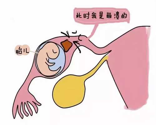 汕头代孕机构：深圳：孕妇等重点人群碘营养偏