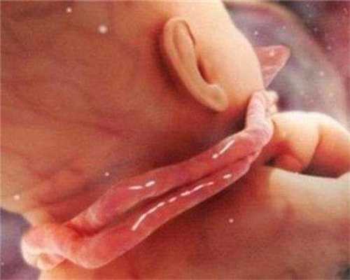 通过人工授精辅助代孕的产妇，产下多胞胎的概
