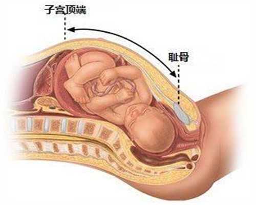 怀孕后肚子总胀气这几种缓解方法很有效_习惯性