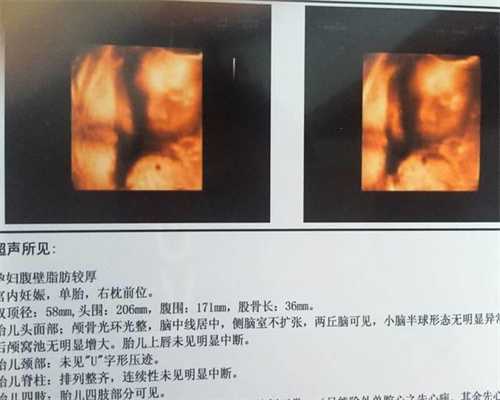 山东省济南医院怎么样：散步对代孕的好处有哪